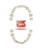 Kavo-Type Tooth Replacement