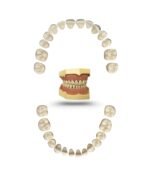 AG3 Tooth Replacement