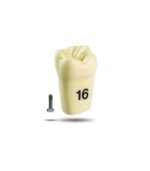 AG3 Tooth Replacement - Image 2
